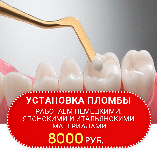 Пломбирование