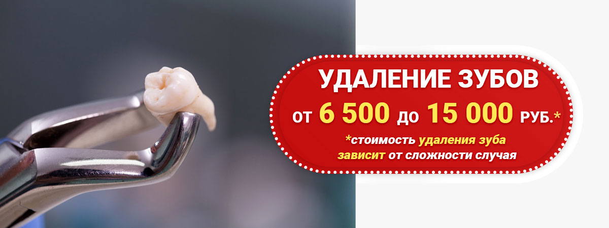 Удаление зуба
