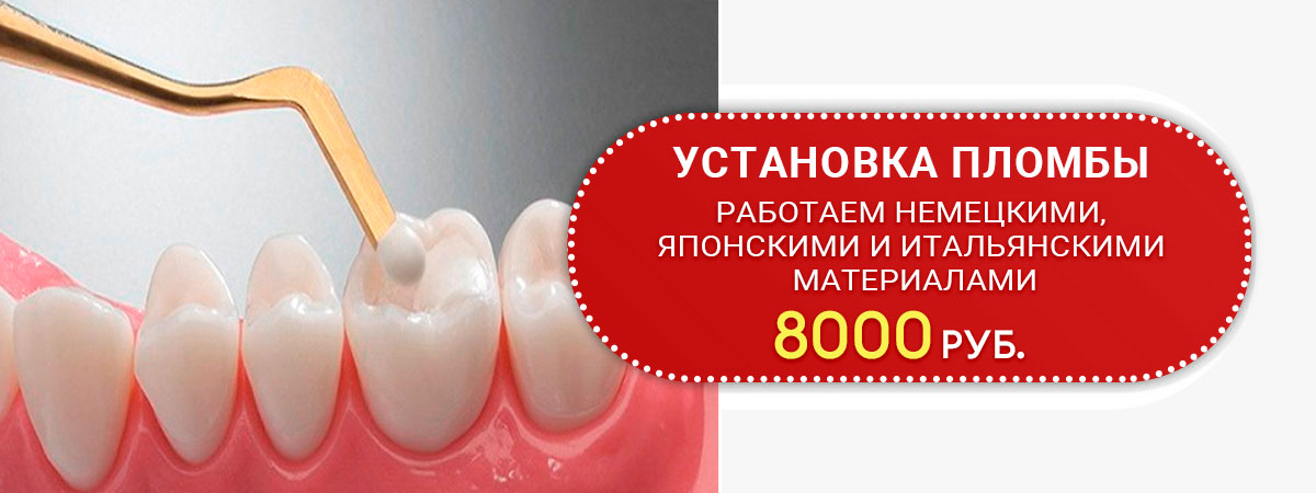 Пломбирование