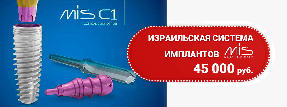 Израильская система